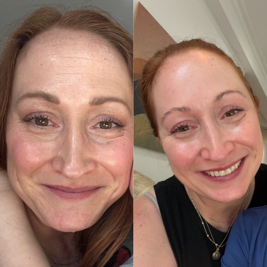 jaime before and after — may 2025 vs june 2026